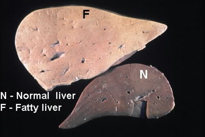 nash liver