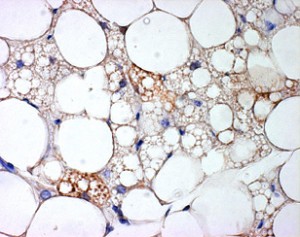 Brown Fat Cells in White Fat Tissue
