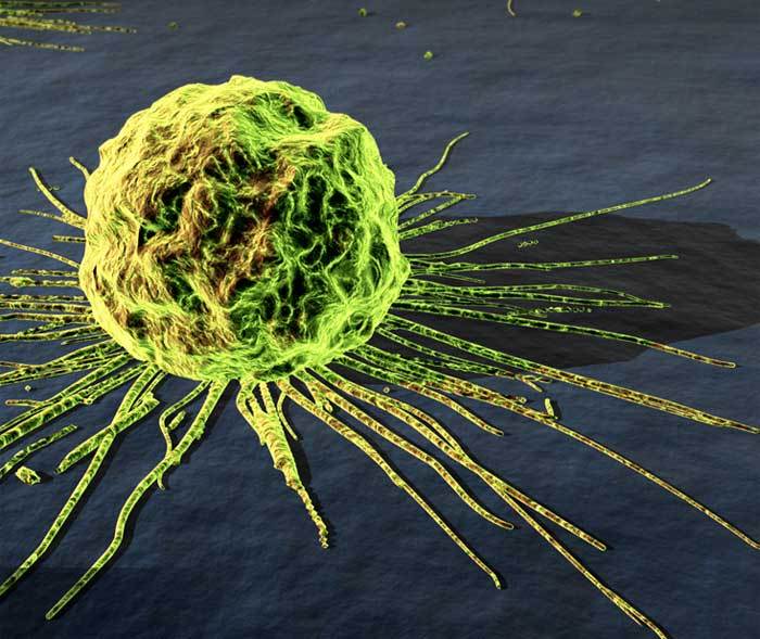 Metastasizing Cancer Cell